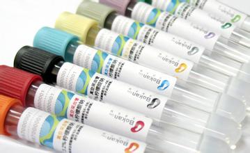 12月8号，PP电子游戏被评为2011年度上海市优良技术带头人