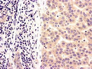 首页| PP电子游戏中国区官方网站