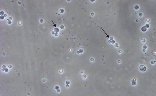酵母双杂交技术道理、试验流程、特点以及利用
