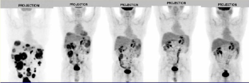 利用PET预测药物的持久药效
