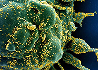 唾液检测新冠抗体新步骤来了，获取了局仅需几幼时！