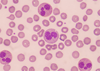 一种神秘颗粒被发现了！它能否成为败血症早筛标志物？