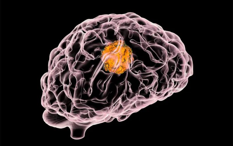 PP电子游戏助力 | 璧辰医药ABM-1310获美国FDA孤儿药资格认证，用于医治携带BRAF V600突变的脑胶质母细胞瘤患者